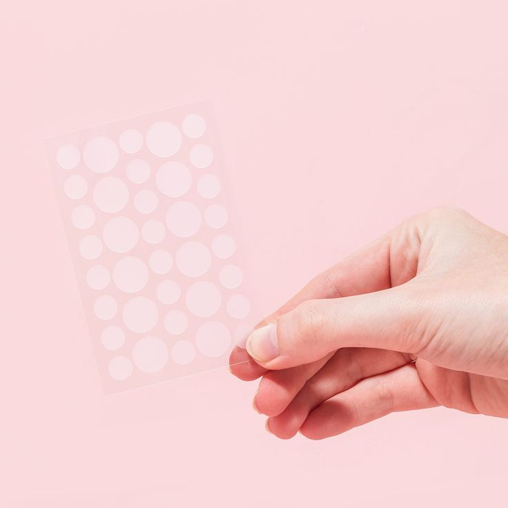 Acne patch