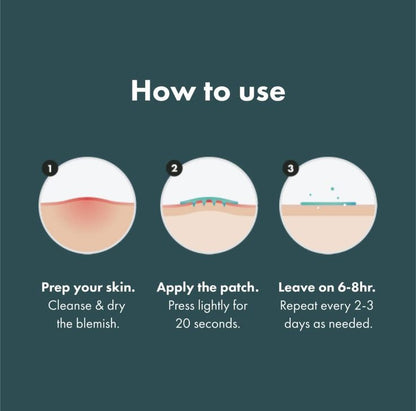 Acne patch